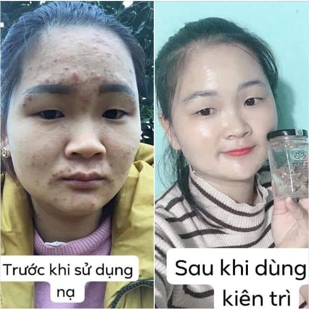 Ảnh khách hàng sử dụng sản phẩm mặt nạ ngủ tổ yến collagen nghệ tây tươi bncare Ảnh khách hàng sử dụng sản phẩm mặt nạ ngủ tổ yến collagen nghệ tây tươi bncare