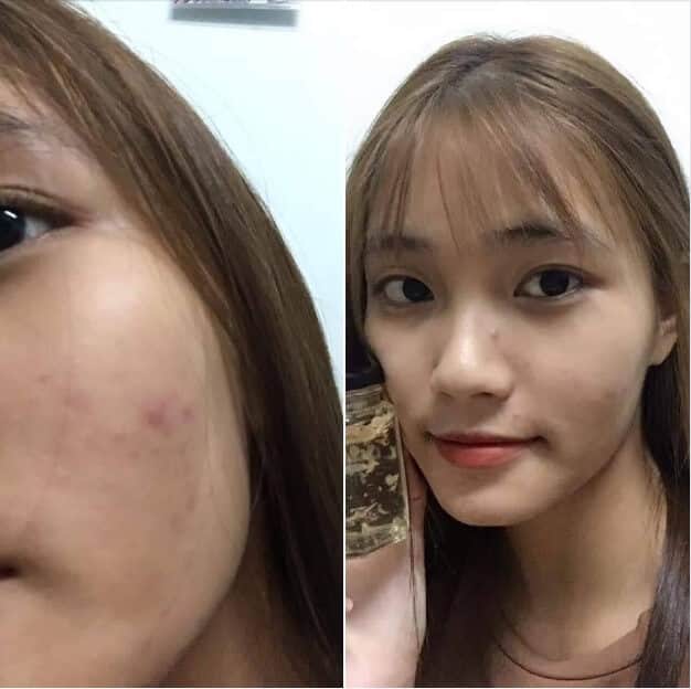 Ảnh khách hàng sử dụng sản phẩm mặt nạ ngủ tổ yến collagen nghệ tây tươi bncare Ảnh khách hàng sử dụng sản phẩm mặt nạ ngủ tổ yến collagen nghệ tây tươi bncare
