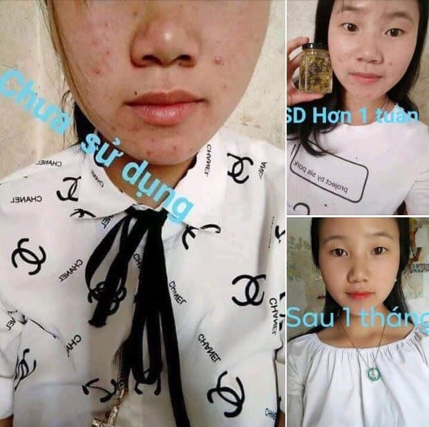 Ảnh khách hàng sử dụng sản phẩm mặt nạ ngủ tổ yến collagen nghệ tây tươi bncare Ảnh khách hàng sử dụng sản phẩm mặt nạ ngủ tổ yến collagen nghệ tây tươi bncare
